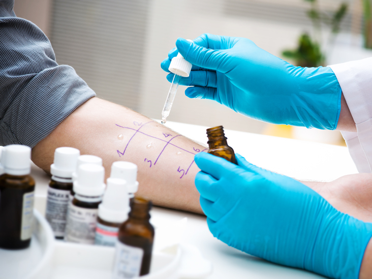Allergy Tests